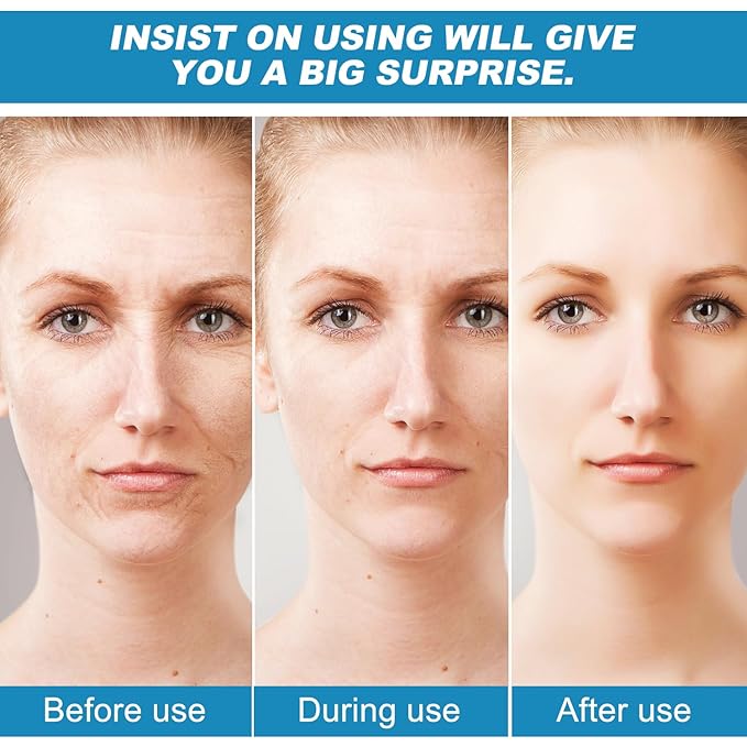 Micro Infusion System for Lips, Micro System for Face, SerumSmooth Skin Facial Serum for All Skin Types (1*Micro System Tool+4* Face Serum)