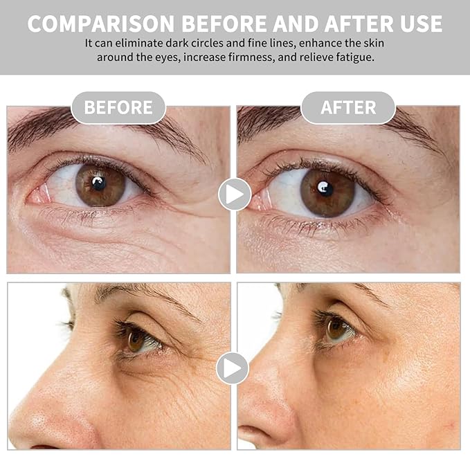 Caffeine Eye Cream Under Eye Cream for Anti-Age Eye Wrinkles Eye Elasticity Fine Lines Cream for Late Nights, Overtime Eye Skin Care For Women & Men