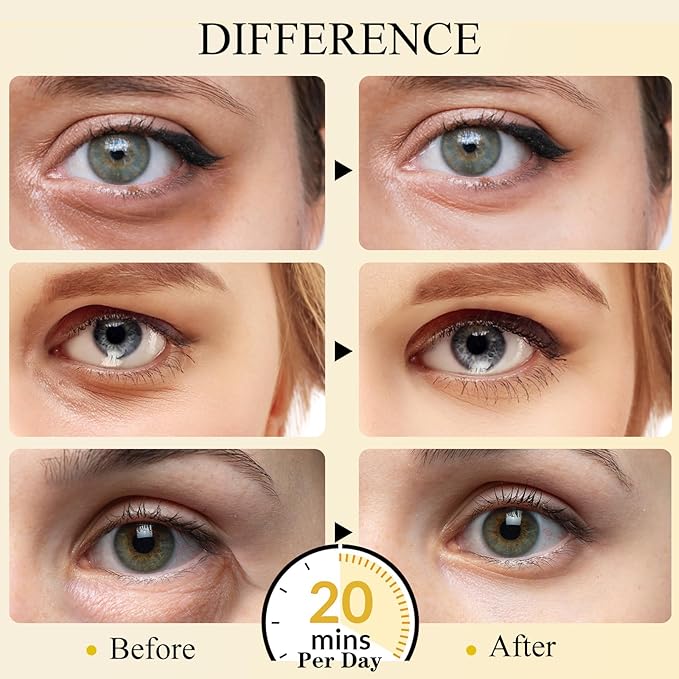 Under Eye Patches(24K Gold 30 Pairs), Gel Eye Mask for Reduce Dark Circles, Puffy Eyes,Undereye Bags, Wrinkles,-with Hyaluronic Acid & Collagen,Eye Treatment Skin Care for Men & Women Gift