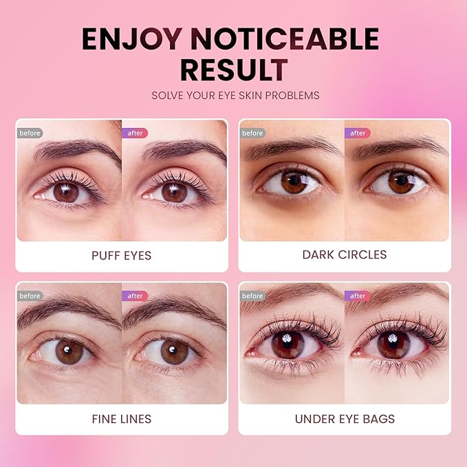 Under Eye Patches (48 Pairs) - New Tri-color Glitter Eye Gel Pads for Dark Circles Puffy Eyes,Under eye Bags,Wrinkles|Natural Collagen Under Eye Mask Patches, Gel Under Eye Patches