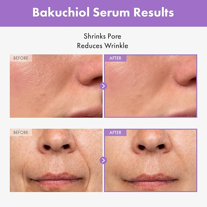 Bakuchiol Serum, 5,000ppm Bakuchiol, Anti-Aging, Pore Minimizer for Face, Hydrating Glow Serum, Facial Moisturizer, Active Skin Repair, Glass Skin, Korean Skincare, 30ml, 1.01 fl. oz.