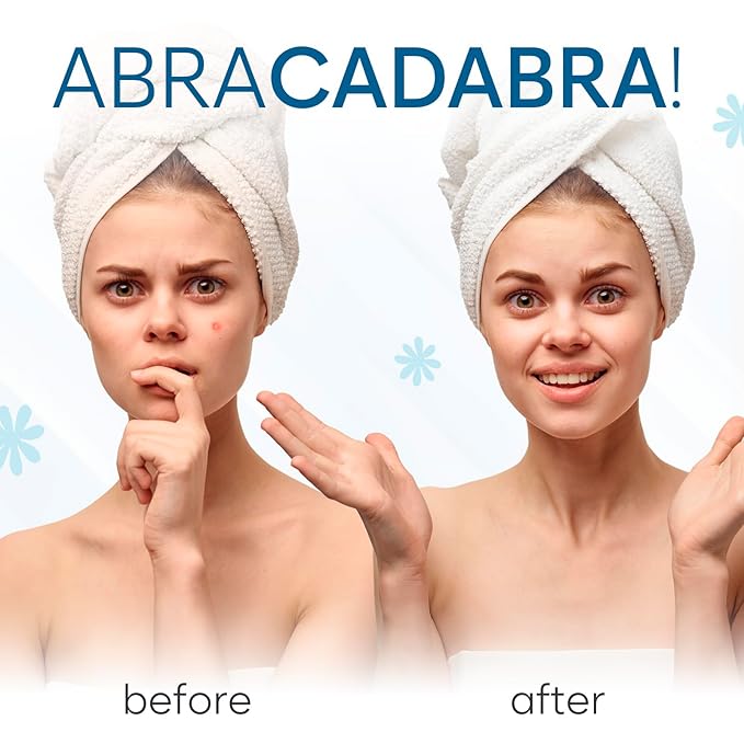 Invisible Pimple Patches (324 Count) - Hydrocolloid Acne Spot Treatment - Zit Patches for Face - Acne Treatment for Face - S/L Sizes