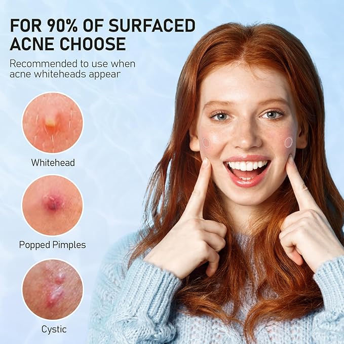 Pimple Patches for Face, 3 Sizes 288 Counts Acne Patches, Hydrocolloid Patches Zit Patches for Skin Care, Blemish Patches Invisible Acne Spot Treatment with Salicylic Acid, Tea Tree Oil