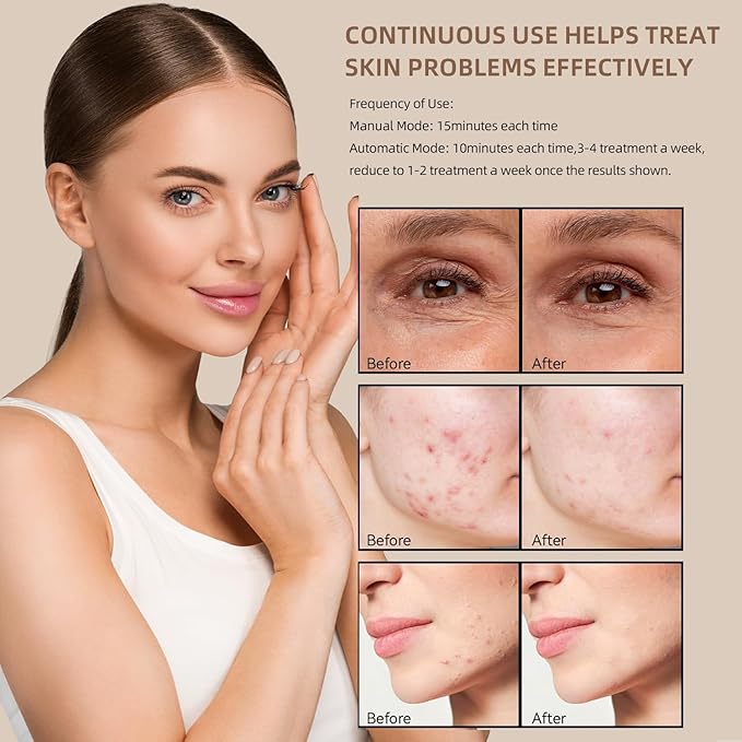 LED light therapy mask FM-01, Mask