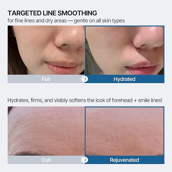 Forehead and Smile Line Wrinkle Patches - Anti Wrinkle Patches for Lip - Face Tape Overnight Self Care for Woman for Smoothing and Firming - Smile Line Patches (12 Pack)