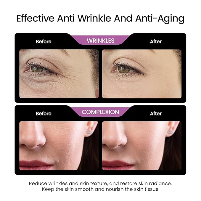 Bakuchiol Retinol Serum Alternative for Face: Bakuchiol Serum With Vitamin B5 and 2% Hyaluronic Reduce Black Spots Suitable for women and men