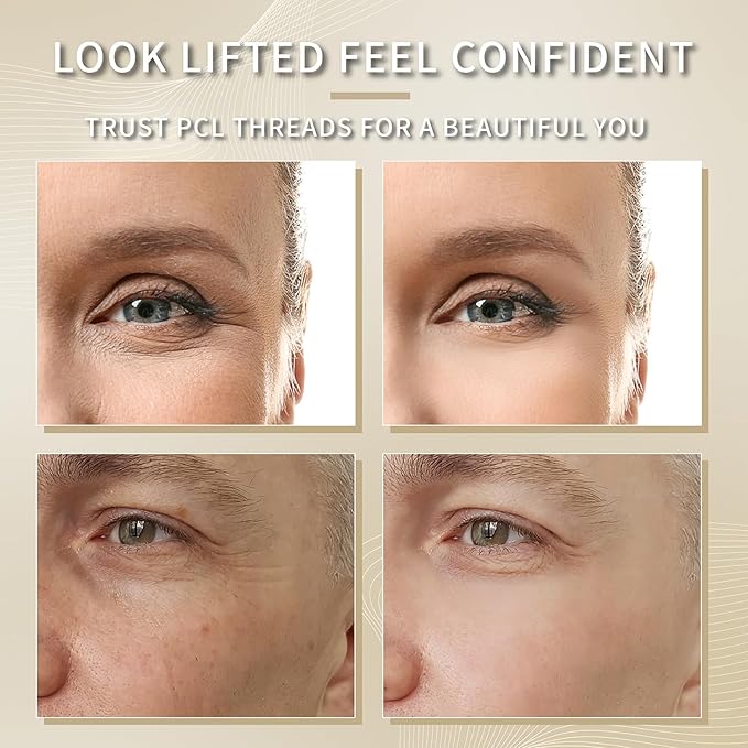 elves PCL Threads for Face Lift Mono Threads 29G25mm Pcl Smooth Threads Sharp Tip PCL Threads Mono 20Pcs Long-Lasting Skin Tightening Smoothing of Wrinkles