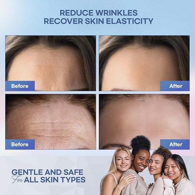 Anti Forehead Wrinkle Patches: Anti Wrinkle Facial Patches overnight- Forehead Wrinkles Treatment 144 pcs (Blue(12pcs))