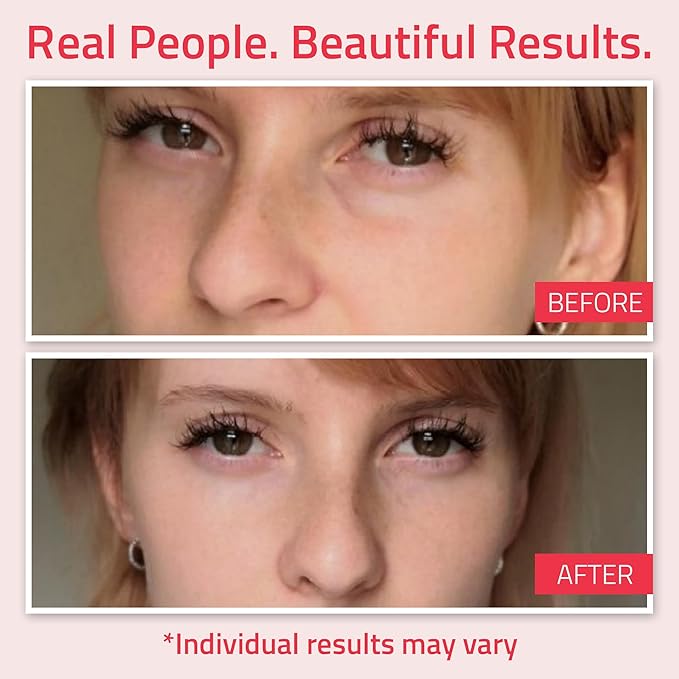 YEOUTH Retinol Eye Cream, Firming Under Eye Cream for Puffiness and Bags Under Eyes for Wrinkles and Dark Circles with Hyaluronic Acid and Tripeptides 1oz