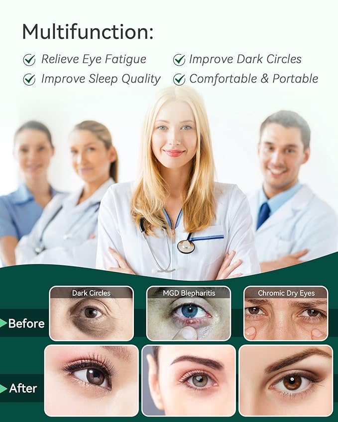 30PCS Steam Eye Masks for Dry Eyes & Fatigue Relief, Self-Heating Eye Mask for Puffiness & Dark Circles, Moist Heat Compress, Travel-Friendly, No Microwave Needed, FSA & HSA Eligible, Unscented