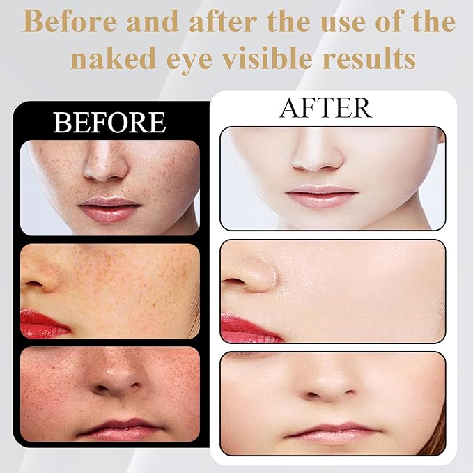 Red Light Therapy For Face,Led Face Mask Light Therapy, 7 Color Red Light Therapy Mask, Rechargeable,Portable,Household Led Face Mask (Pink)