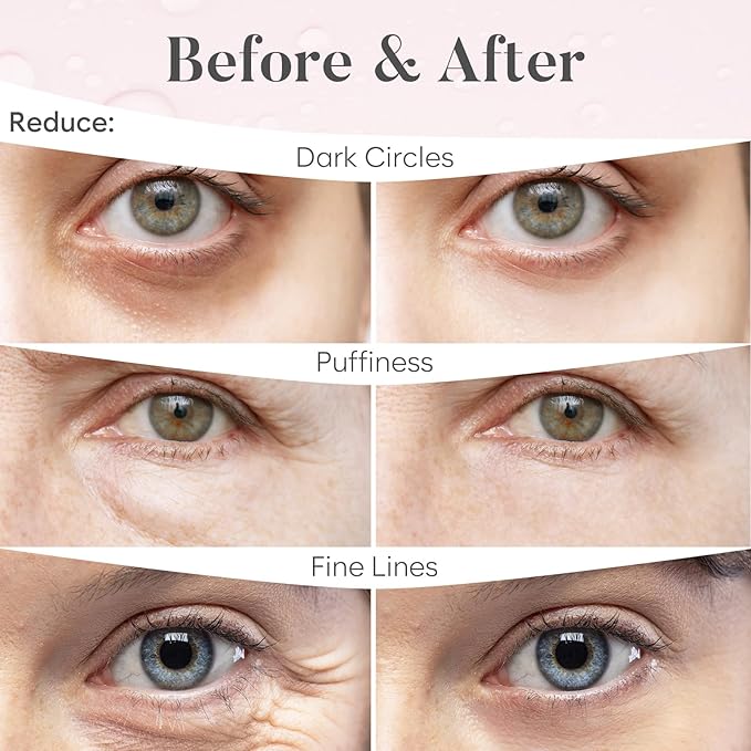Rose Under Eye Patches (30 Pairs) Under Eye Patches for Dark Circles, Under Eye Patches for Puffy Eyes and Dark Circles, Under Eye Mask, Puffy Eyes Treatment, Eye Care, Eye Masks Bulk