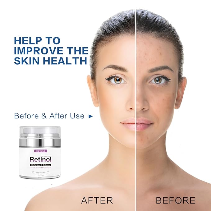 MO TULIP Face Cream with Retinol, Collagen & Hyaluronic Acid – Face & Neck Firming Moisturizer for Wrinkles, Hydration & Lifting – Day/Night Cream for Women & Men (1.7 fl.oz)