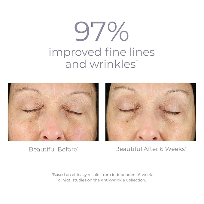 Derma E Anti-Aging Regenerative Night Cream – Firming Astaxanthin Moisturizer For Face – Lightweight Overnight Anti-Wrinkle Cream With Jojoba Oil And Vitamin E, 2 oz