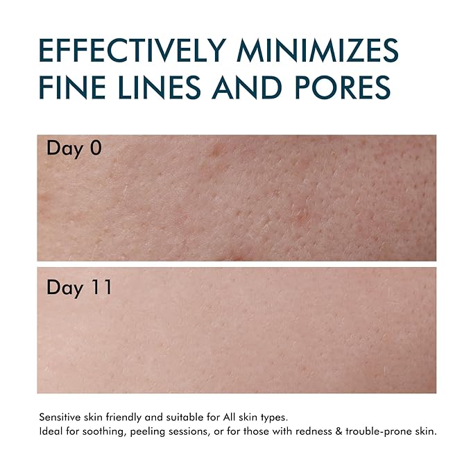 Stem Cell Serum for Face, Anti Aging Microneedling Serum Uses with or without Micro Needling, Smooths Wrinkles and Moisturizes Skin