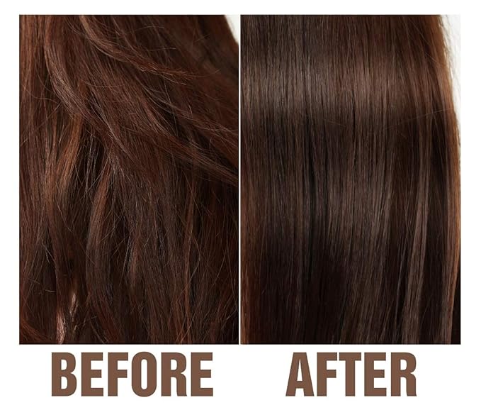 Olivia Care Tea-Tree & Aloe Scalp Serum - Natural & Vegan Ingredients - Moisturize & Anti-Itch Treatment - Stimulate Hair Growth & Repair Damage - 4 FL OZ