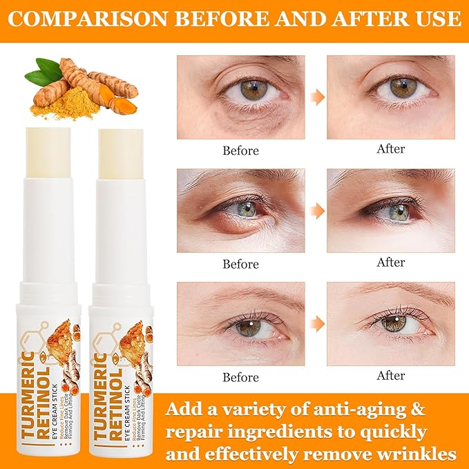 2PCS Eye Bags,Eye Balm Stick Wrinkles,Hydrating for Dark Circle,For Puffiness and Bags Reduces Fine Lines