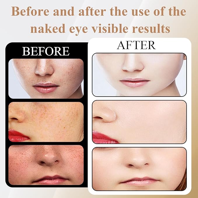 Red Light Therapy For Face,Led Face Mask Light Therapy, 7 Color Red Light Therapy Mask, Rechargeable,Portable,Household Led Face Mask (Black)