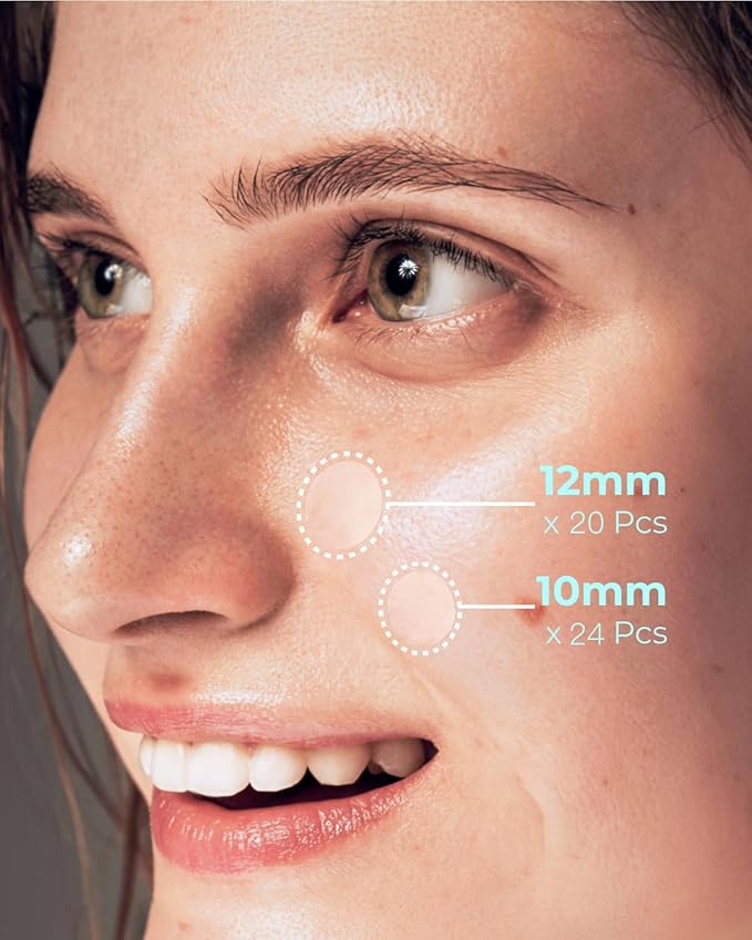 Pimple Patches for Face Acne: Invisible 0.1mm Ultra-Thin Hydrocolloid Zit Stickers with Tea Tree Oil - 44 Dots, 2 Sizes (Whiteheads/Sensitive Skin)