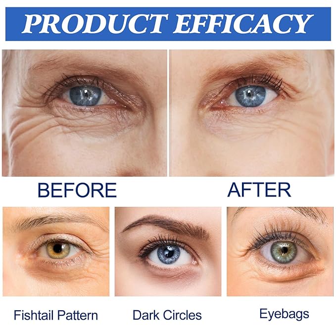 6 Picecs Malora Microglow Eye Patches,Hyaluronic Patchess for Under,Malora Under EyePatches for Wrinkles,Reduces Puffiness & Eye Bags,Under Eye Wrinkles Hydrating Sticker Mask (1Box)