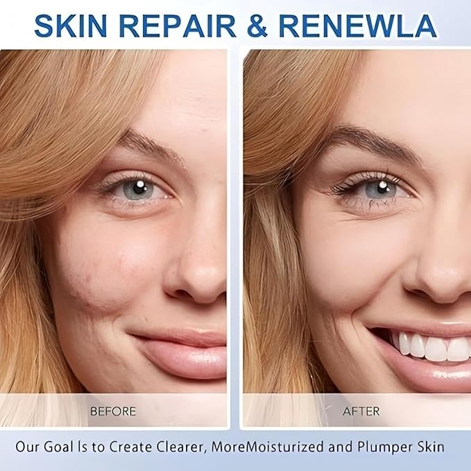 30 Pcs 5% Hyaluronic Acid Serum Vials (1.5ml Each), 5% Ultra-Hydrating Anti-Aging Face Serum for Women & Men, Deep Moisture, Wrinkle Reduction & Plumping, Portable Single-Use Tubes for Travel