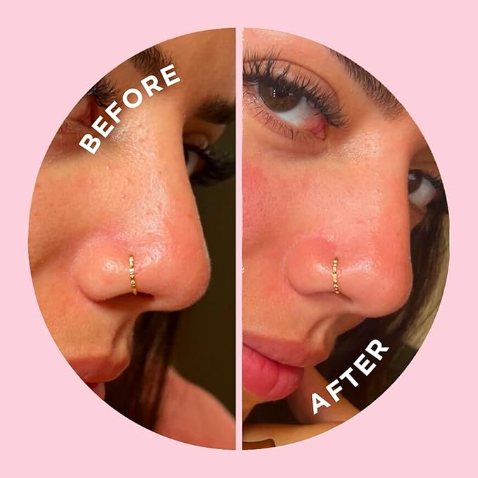 ZitSticka Hydrocolloid Surface Area Pimple Patches for Face - Clarifying Pore & Blemish for Large Zit T-Zone Coverage - Zit Sticker Absorbs Oil, Unclogs Pores, & Targets Clusters (NOSE PACK 8PC)