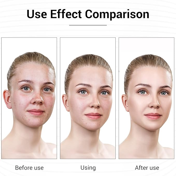 L E D Face Mask Light Therapy, 7 Colors L E D Light Therapy Mask, Red & Blue Light Therapy for Face, Light Mask for Skin Care, Portable Rechargeable