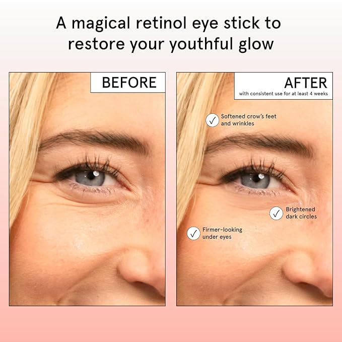 grace & stella Under Eye Brightener Balm Stick - Travel Size Toiletries - Retinol & Caffeine Eye Cream for Dark Circles, Puffiness, Wrinkles - Hydrate and Brighten - Vegan Skincare (0.13oz / 3.5g)