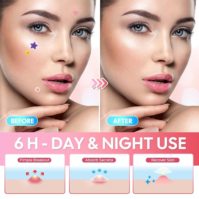 Pimple Patches Thin Pimple Patches for Face Acne patches Acne Treatment for All Skin Types Unscented Vegan & Cruelty Free Hydrocolloid & Tea Tree Formula for Blemishes Redness & Pore Treatment