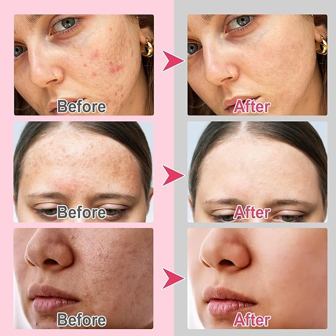 Turmeric Cleansing Pads, 60PCS Turmeric Cleansing Pads for Dark Spots, Turmeric Face Scrub Pads for Face Cleansing and Exfoliation, Helps Balance Skin Oil and Water