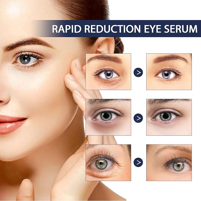 Rapid Reduction Eye Serum - Advanced Formula - Anti Aging Serum Visibly Reduces Under-Eye Bags