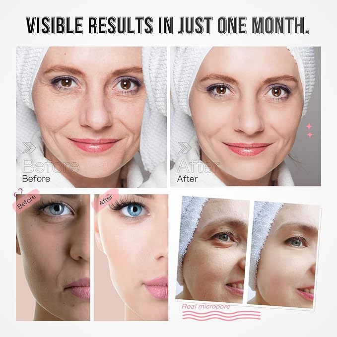 Led Face Mask Light Therapy, Red Light Therapy For Face, 3 Colors LED Skin Mask With Near infrared light, Skincare Device for All Skin Types at Home (White)