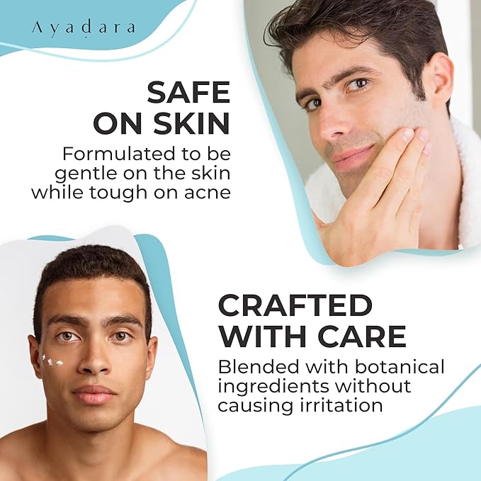 Day & Night Cystic Acne Spot Treatment, Hormonal Acne Treatment For Daytime & Overnight, Severe Acne, Cystic Acne Treatment for Face, Pimple Cream Tea Tree Bentonite Clay, 90 Day Supply