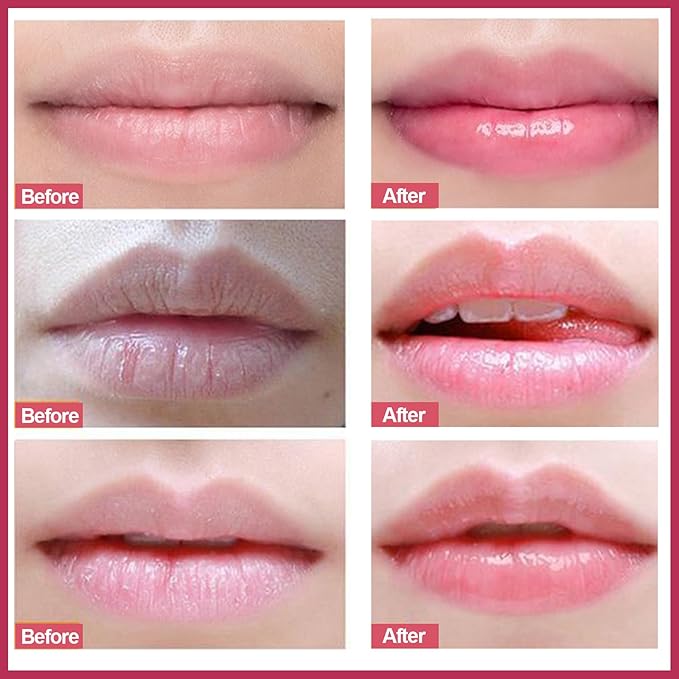 MIELIKKI Lip Scrub, Lip Scrubs Exfoliator, Sugar Lip Polish, Lip Exfoliator Scrubber for Chapped and Dry Lips, Lip Moisturizer, Lip Care Products, Strawberry