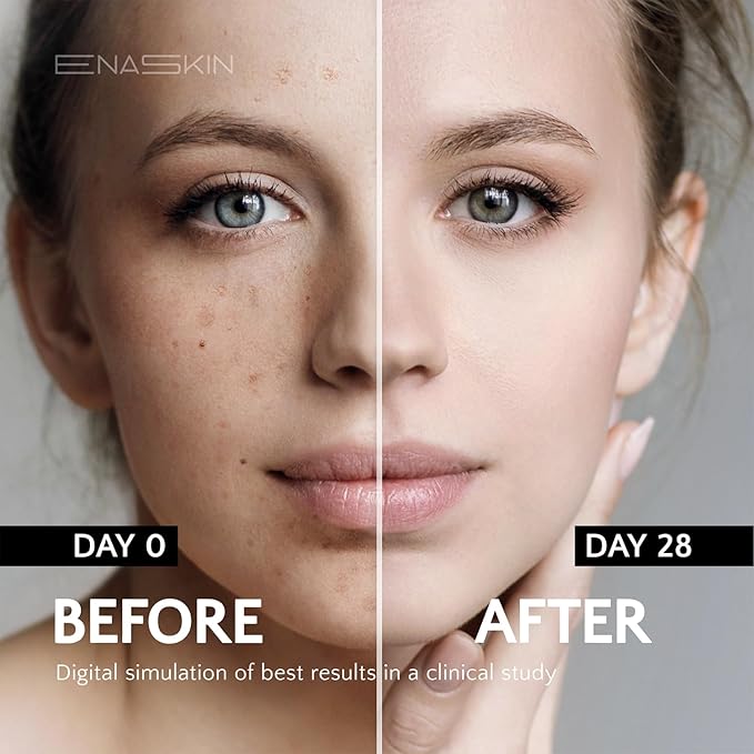 Dark Spot Corrector for Face and Body: EnaSkin 50ML Spot Remover for Age Spot Sun Spot Freckles Melasma Brown Spot for Men and Women (1.7 Fl Oz)