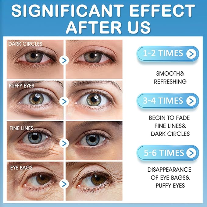 Sulily 30 Pairs Strawberry Lip Masks&Gold Dust Light Green Eye Masks,Crystal Collagen Eye Patches for Puffy Eyes,Moisturizing Cooling Skin Care Lip Eye Patches for Puffiness and Dark Circles