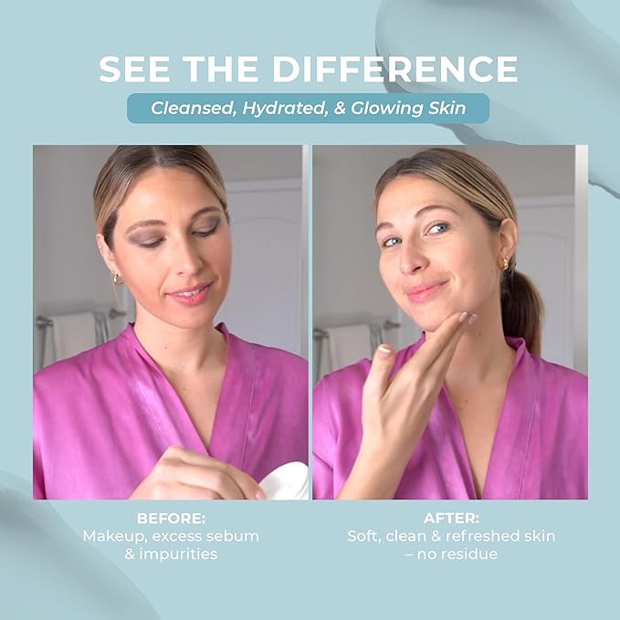 Seoul Cleansing Balm-To-Oil Make Up Remover | 3-In-1 Formula - Cleanses, Removes Makeup & Moisturizes Skin | Korean Makeup Remover Balm | Safe on Skin | 30ml/1.01 Oz