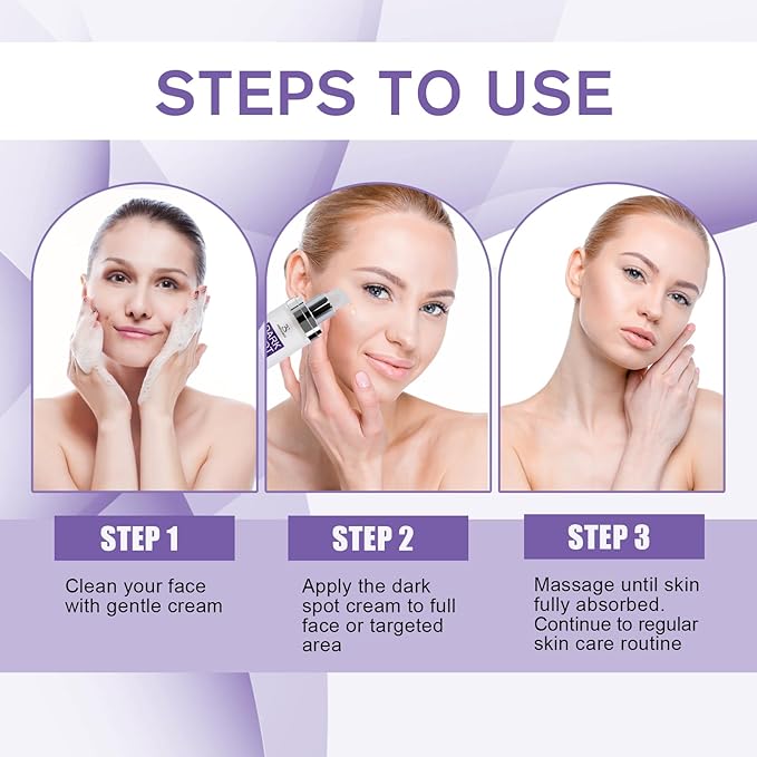 [Upgraded] Dark Spot Remover for Face, Dark Spot Correcting Glow Serum with Niacinamide Retinol and Vitamin C, Rapid Skin Brown Spot Remover, Sun Spot Age Spot Corrector for Daily Skincare 1FL,OZ/30ML