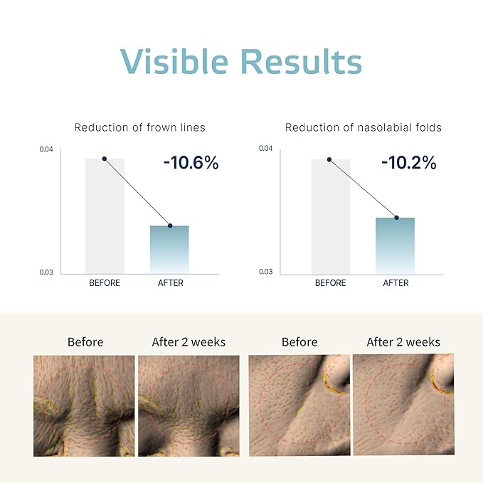 Forehead Wrinkle Patches – 8pcs | Labottach Korean Skincare Hydrogel Firming Patch for Between Eyes, Smile Lines & Fine Lines with Adenosine, Tartaric Acid | Stretch & Lift | Home Skin Care