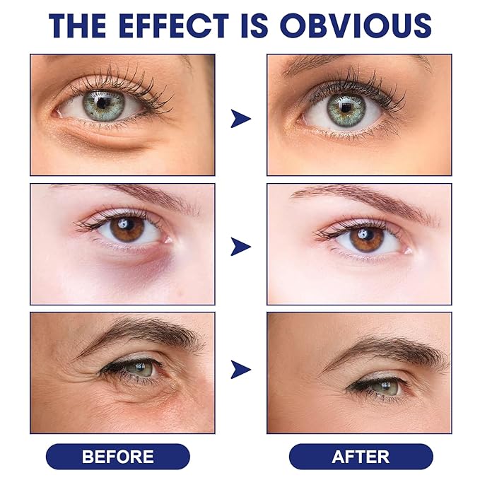 Sea Gril Anti Wrinkle Serum, Peg-8 Complex Anti Wrinkles Essence, Glozie Eye Serum, Anti Aging Firm Eye Cream, Glozie Instant Eye Lift Cream,Temporary Eye Tightener(2PCS)