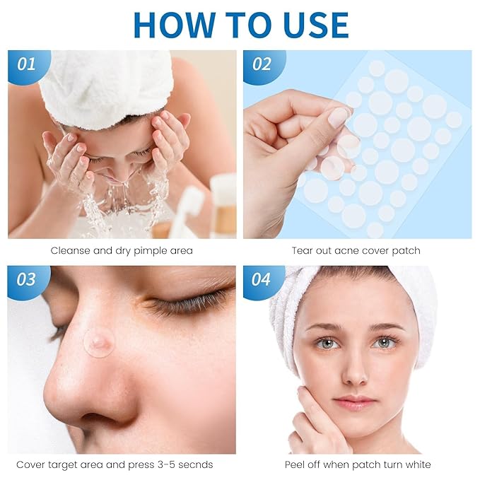 180 Counts Original PimPle Patches for Face, Hydrocolloid Acne Pimple Patch with Tea Tree Oil for Party Gift Covering Zits Blemishes