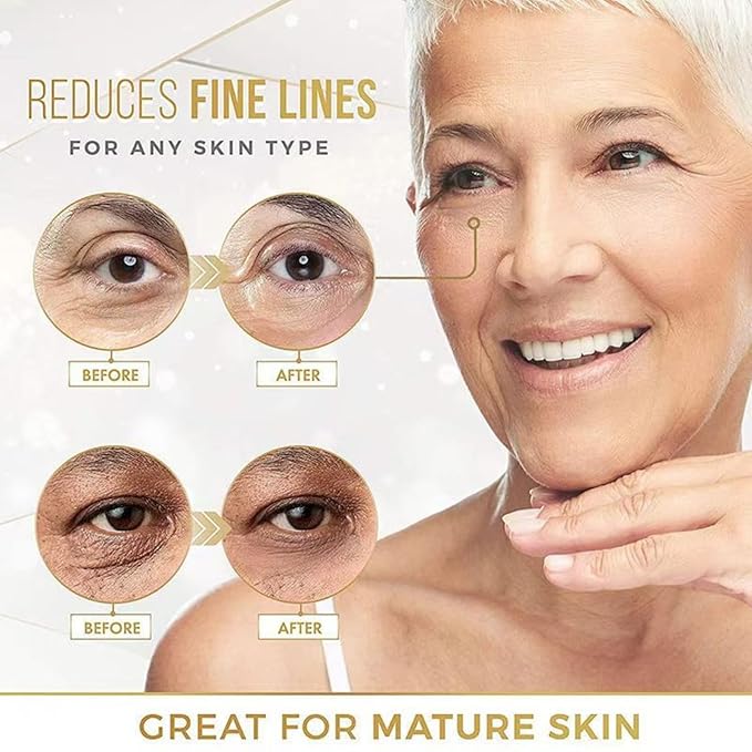 Hyaluronic Acid Eye Patch (Removes Dark Circles, Eye Bags, Eye Care, Wrinkles, Puffy Eyes, Skin Cushioning) - Anti-Aging Moisturising 60PCS. For both men and women