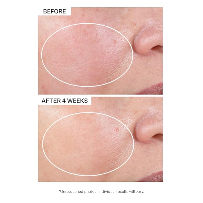 StriVectin Advanced Retinol Intensive Night Moisturizer, Targets Visible Signs of Aging for Healthier Skin, 1.7 Fl Oz