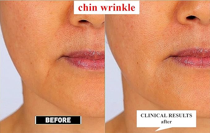 [K-Beauty Retinaldehyde 1000ppm & Liposome Anti-Wrinkle Night Repair Cream (1oz /30ml)