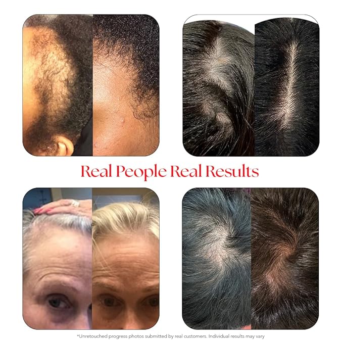 HAIRtamin Scalp Serum Natural Hair Growth Thickening Treatment | Made in USA | Helps Increase Hair Thickness and Aids Against Hair Thinning and Hair Fall Out | Moisturizes and Soothes Dry Itchy Scalp