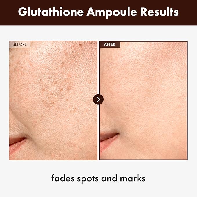 Glutathione Serum with 20,000ppm Glutathione, Niacinamide and hyaluronic acid, Dark Spot, Improve skin elasticity, Revitalize complexion, Korean Skincare, 30ml, 1.01 fl. oz.