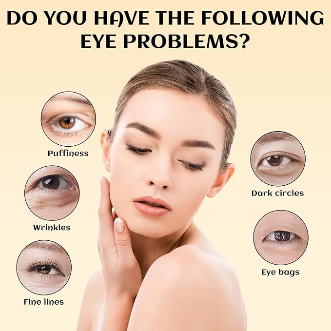 2PCS Eye Balm For Under Eye Bags, Turmeric Eye Bag Cream For Dark Circles, Dark Circles Under Eye Treatment, Eye Balm For Under Eye Bags, Deeply Moisturizes, Fade Fine Lines, Anti Wrinkle 2PCS