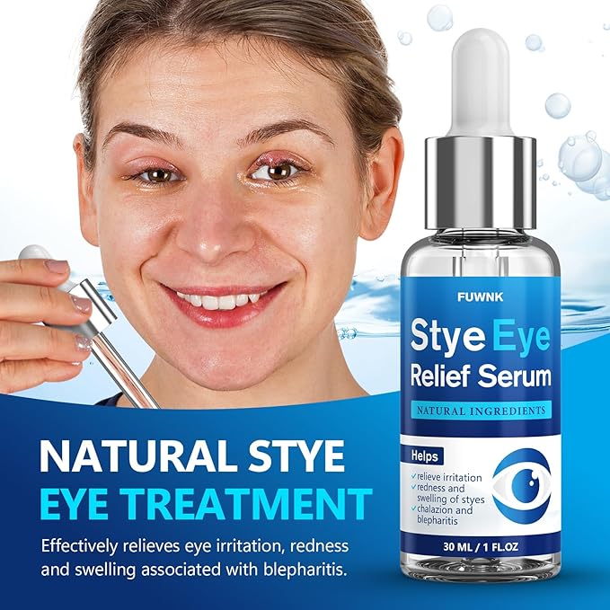 Stye Eye Treatment Serum, Eye Stye Remover for Chalazion, Blepharitis & Stye Removal, Natural Stye Eye Drops, Safe & Fast Relief, 30ml