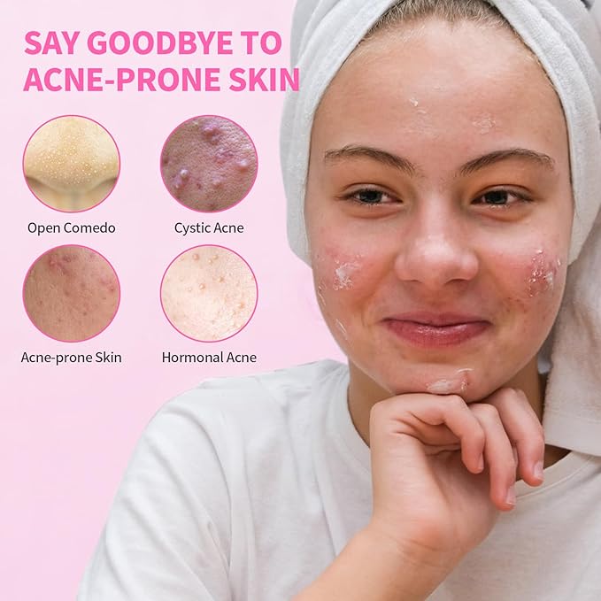 Acne Serum for Face, Back and Body, Gentle Skin Care for Acne Prone Sensitive Skin | For Women & Men