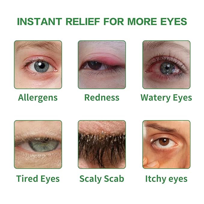 Okra Eye Care Patch,Effective Relief for Itchy, Dry Eyes, Hypoallergenic & Soothing for Sensitive Eyes, Individually Wrapped, Pack of 14